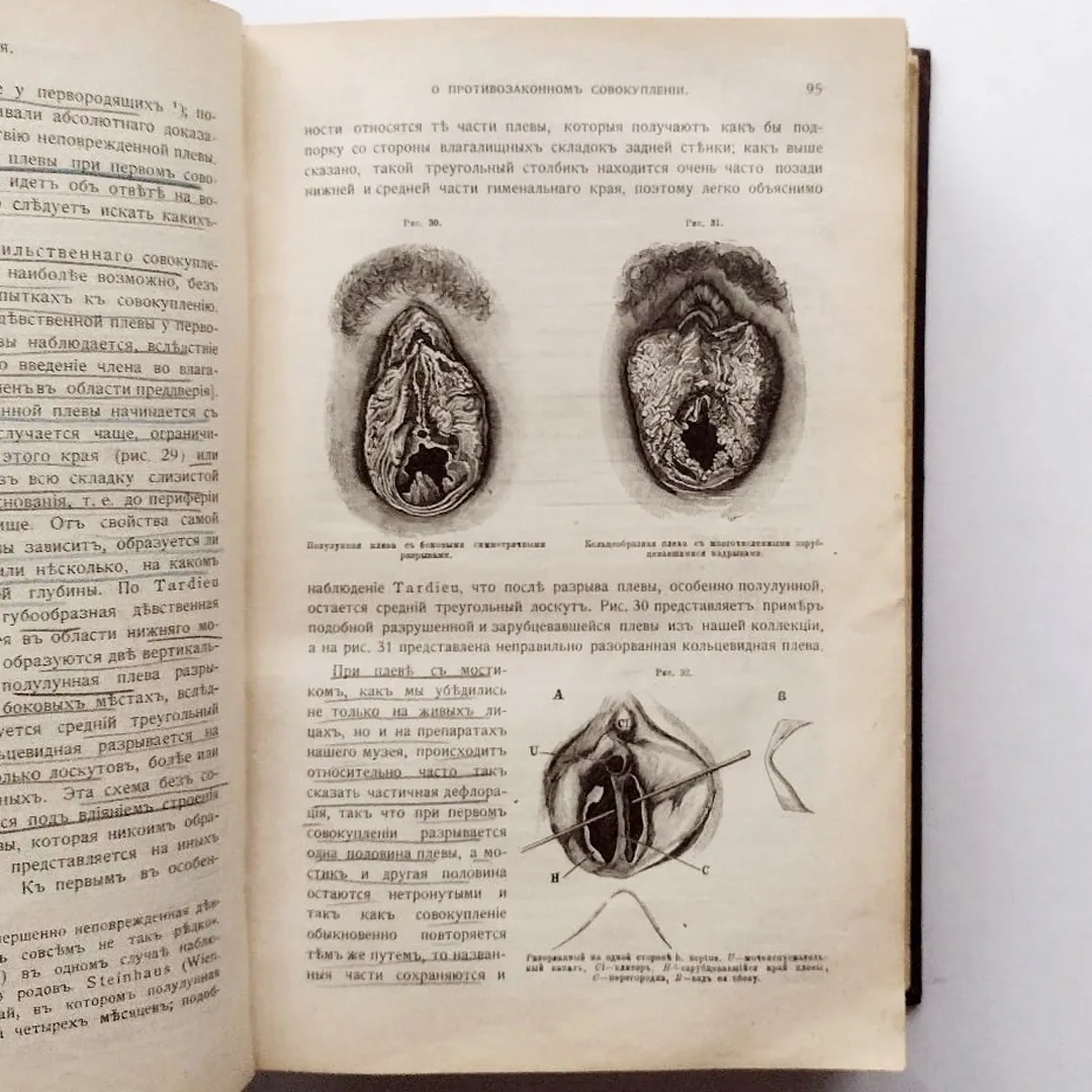 Учебник судебной медицины. Гофманн (1912)